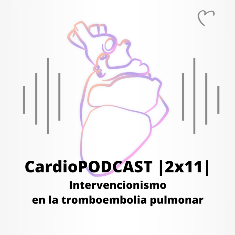 CardioPODCAST |2x11| Intervencionismo en la tromboembolia pulmonar