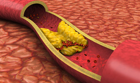 la hipercolesterolemia reduce el perfil antioxidante y cardioprotector de las hdl
