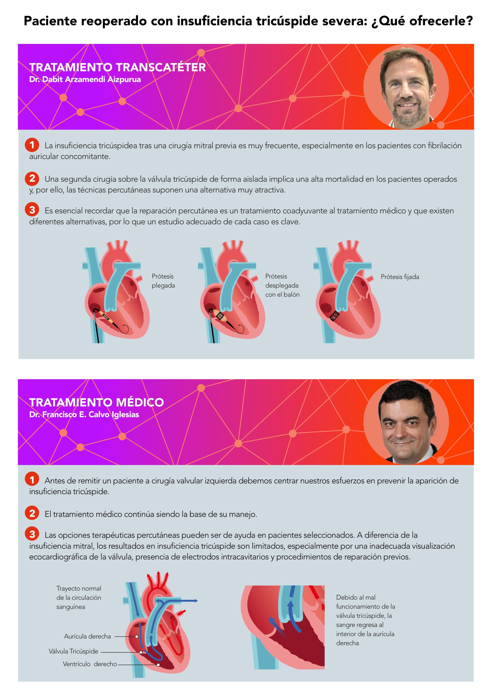 Timing del DAI en insuficiencia cardiaca