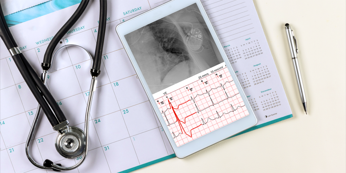 Dispositivos intracardiacos en el tratamiento de la insuficiencia cardiaca: cuándo, a quién, en qué orden, qué tipo, para qué...