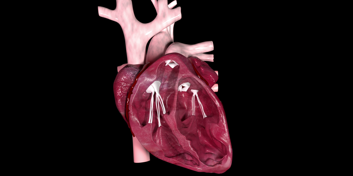 Actualización en valvulopatías y patología aórtica