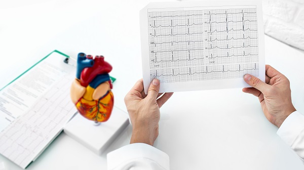 Electrocardiograma: una prueba de bajo coste que permite evaluar el riesgo de muerte súbita