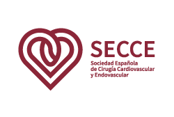 SECCE