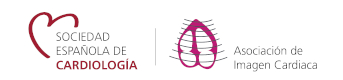 Logo Imagen Cardiaca - Sociedad Español de Secardiología