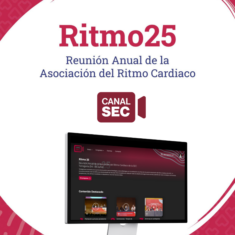 Ritmo 25