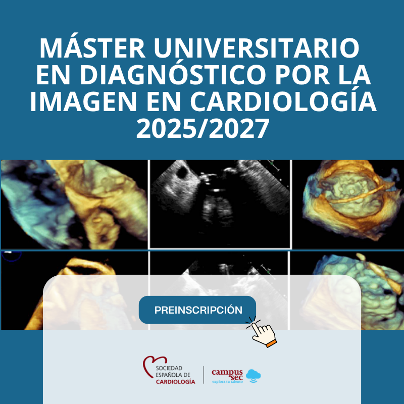 Máster Universitario en Diagnóstico por la Imagen en Cardiología 2025/2027